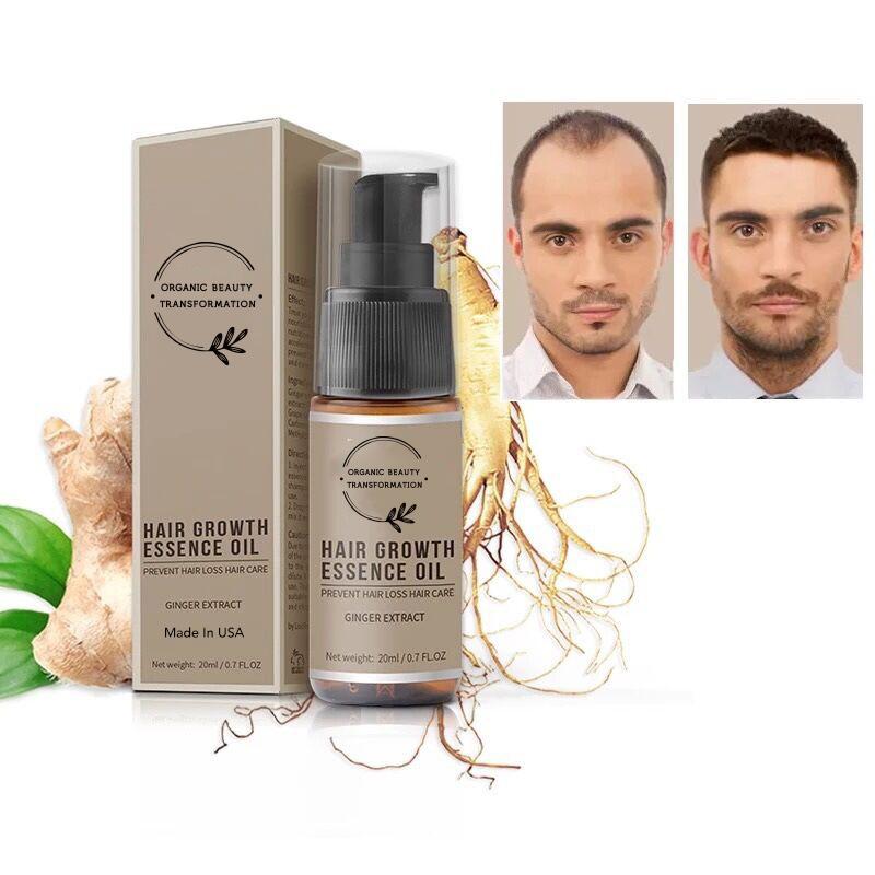 Organic Hair Growth Essence Oil - Organic Beauty Transformation